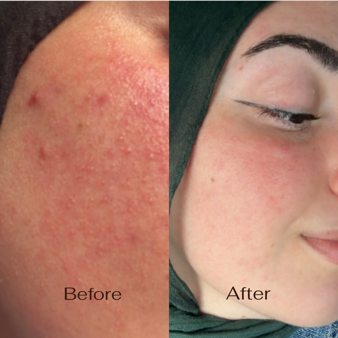 Revitalising Skincare Set