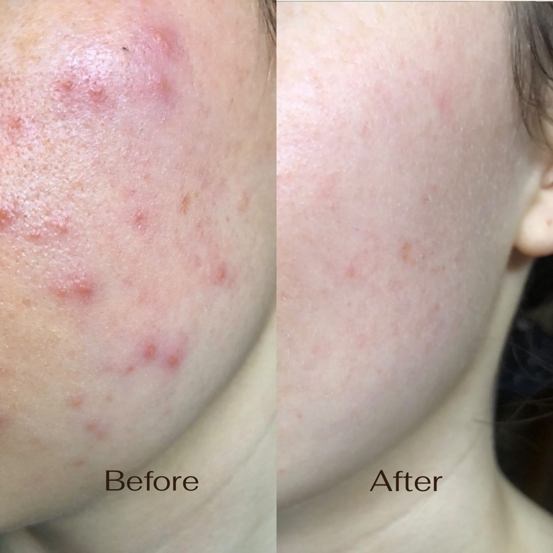 Luna Overnight Crème